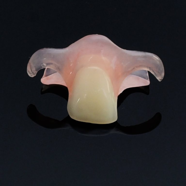 Exploring The Benefits Of Nesbit Partial Dentures